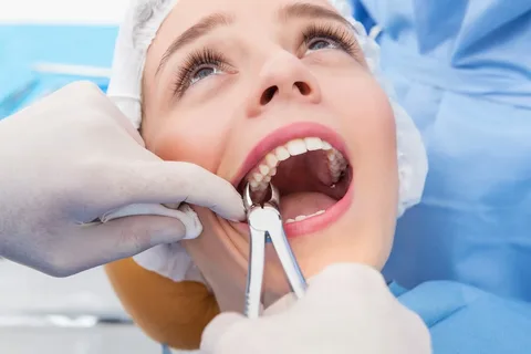 wisdom teeth removal Enmore